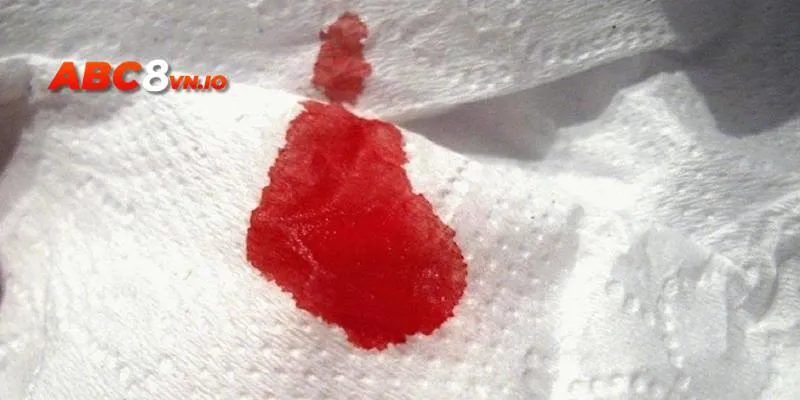 Điềm báo thể hiện giấc mơ thấy máu người chết