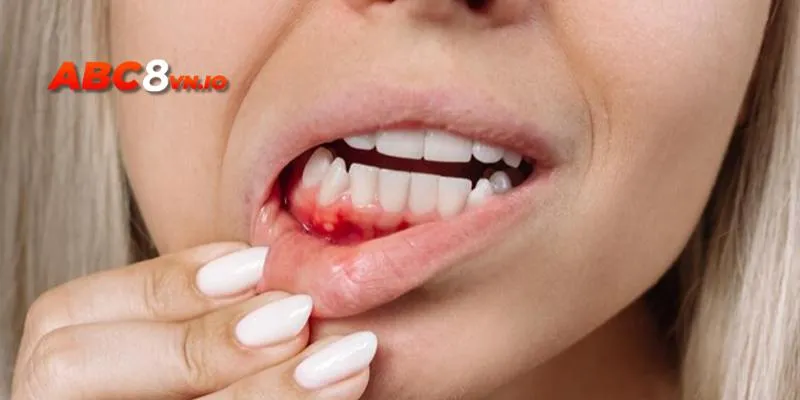 Mơ chảy máu răng thể hiện điềm báo nguy hiểm về thể trạng, trực khỏe 